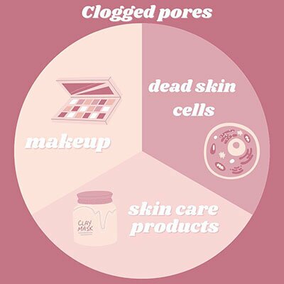 infographic - clogged pores are caused by makeup, skin care products, dead skin cells