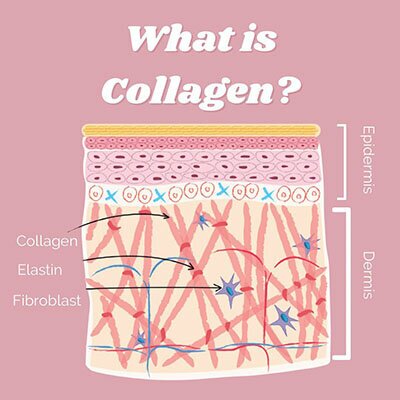 Diagram: What is collagen? - Epidermis, Dermis, Collagen, Elastin, Fibroblast.
