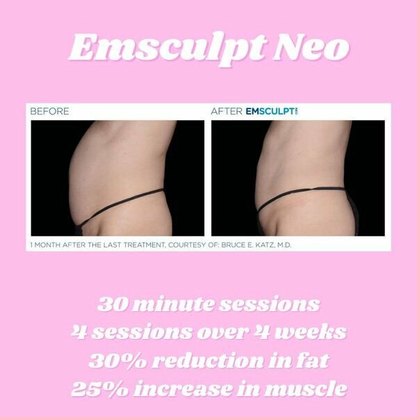 Emsculpt neo before and after image