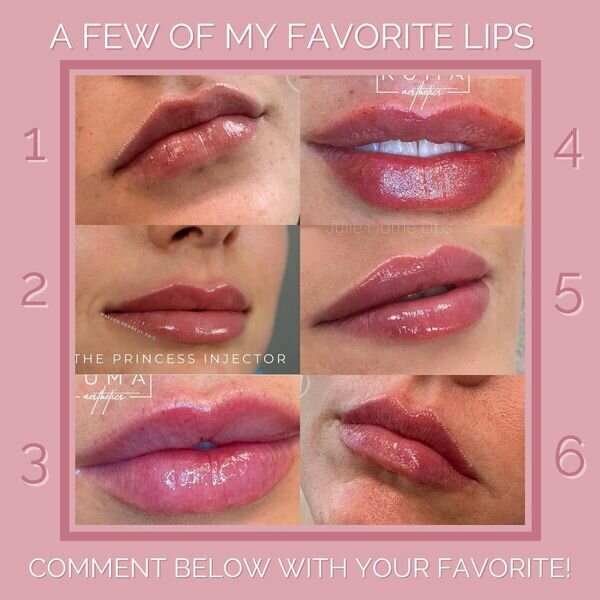 A few of my favorite lips - 6 pictures of lips