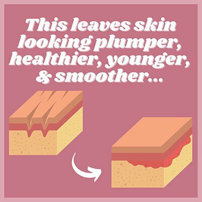 This leaves skin looking younger, healthier, plumper and smoother