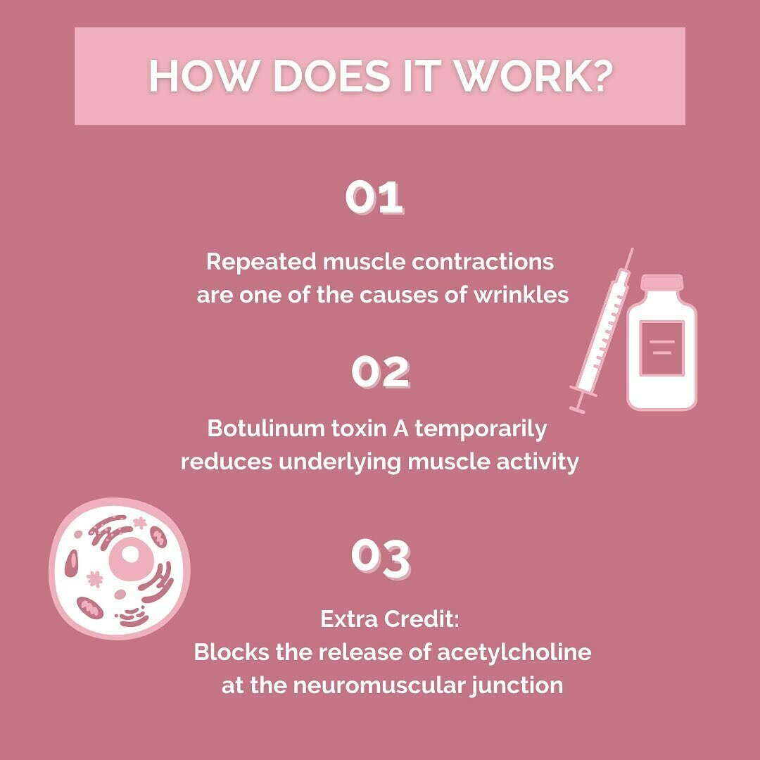 How does it work? 01 Repeated muscle contractions are one of the causes of wrinkles, 02 Botulinum toxin A temporarily reduces underlying muscle activity, 03 Extra credit: Blocks the release of acetylcholine at the neuromuscular junction.