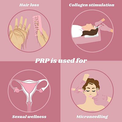 Prp is used for Hair loss, collagen stimulation, sexual wellness, microneedling.