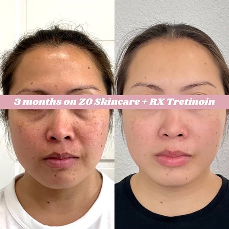 Medical Grade Skincare Before & After Image